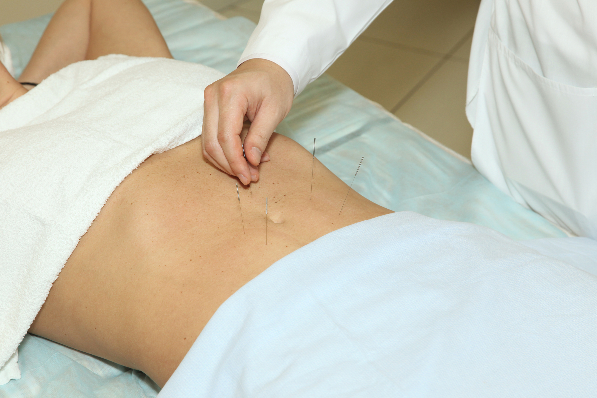 3 Ways Acupuncture & Chinese Medicine Can Help Digestive Issues.jpg