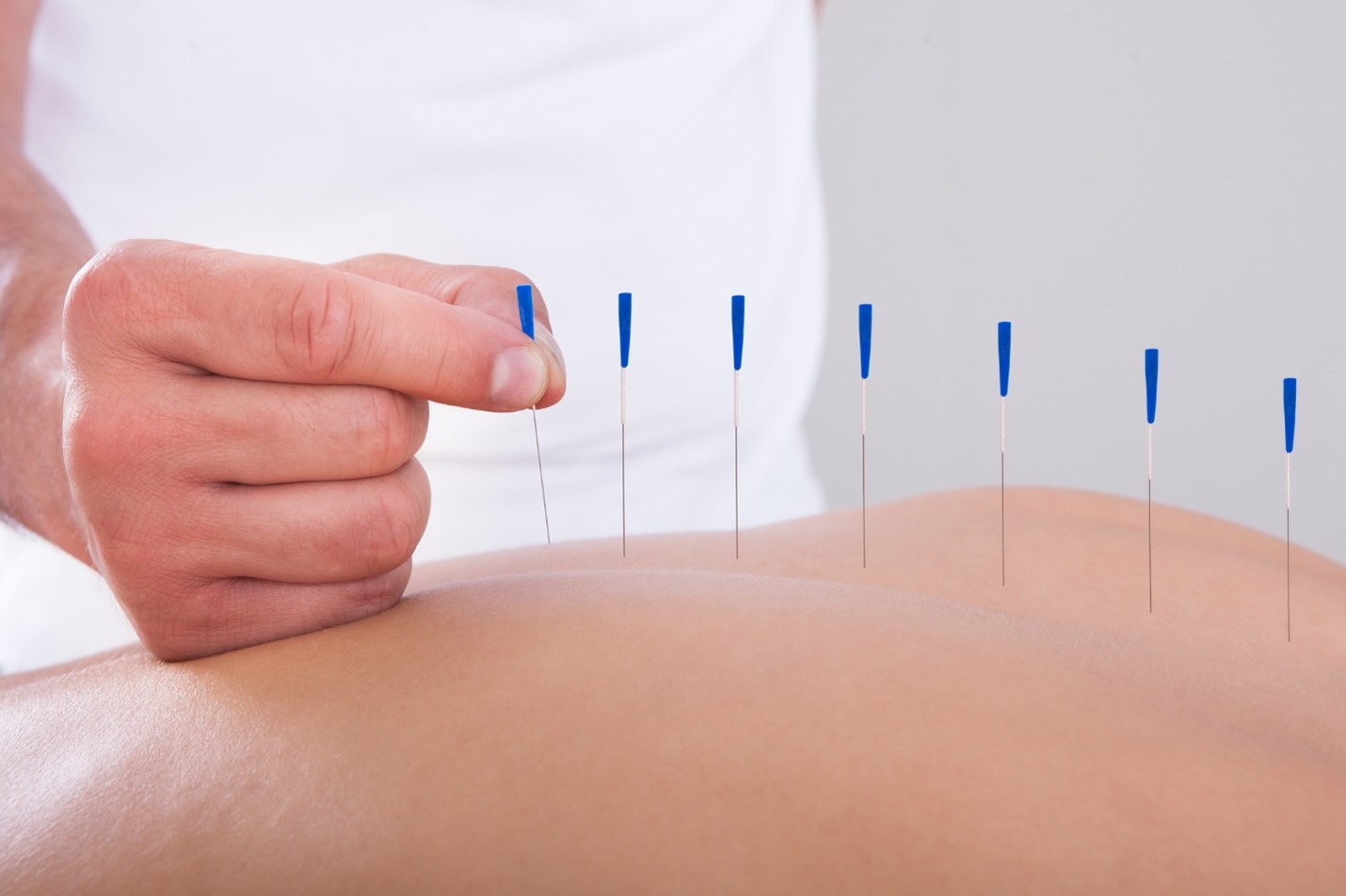 Stimulate Cognitive Function with Acupuncture and Chinese Herbs.jpg